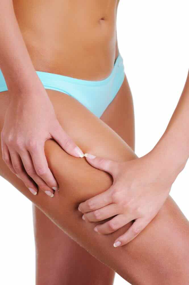 Nutrizionista esperto nel trattamento della cellulite?